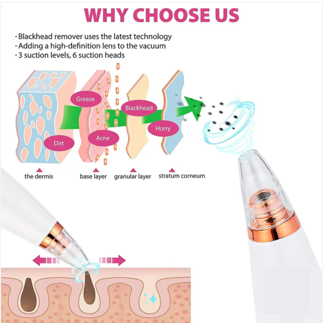 6 in 1 multifunction blackhead remover