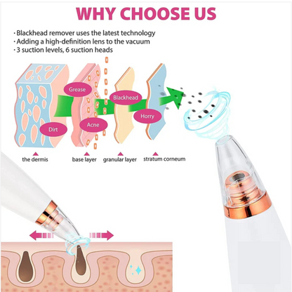 6 in 1 multifunction blackhead remover